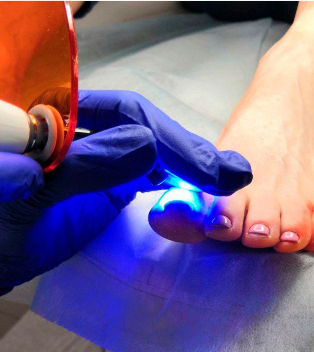 Pedicure Clínico en Santiago - Podóloga Pamela Santiago Centro